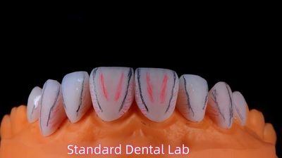 Standard Dental Lab Co., Limited linia produkcyjna producenta