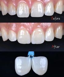 Standard Dental Lab Co., Limited linia produkcyjna producenta