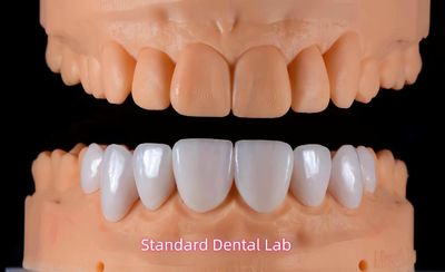 Standard Dental Lab Co., Limited linia produkcyjna producenta