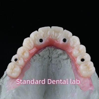 kupować Porcelanowy most z implantami dentystycznymi z cyrkonii Profesjonalna wysoka estetyka z różową gumą produkcja internetowa