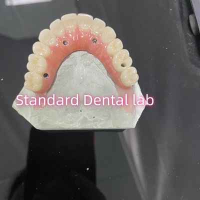 kupować Wszystkie na cztery sześć Ivoclar Zirconia Implant Bridge Titanium Bar z różowej gumy porcelany produkcja internetowa