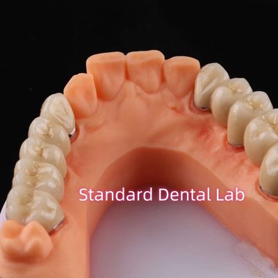 kupować Cyfrowa korona porcelanowa z metali niecennego PFM most dentystyczny produkcja internetowa