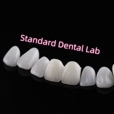 kupować Odporny na ścieranie Emax Zirconia Laminate Veneers Incisal Translucency produkcja internetowa