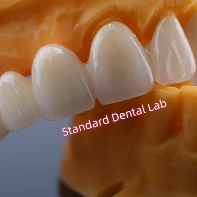 kupować CAD CAM Mill Zirconia Crown Bridge Wysoce biokompatybilny produkcja internetowa