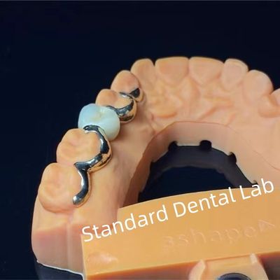 kupować Zęby dentystyczne PFM Maryland Bridge Wysoka estetyka Certyfikat FDA produkcja internetowa