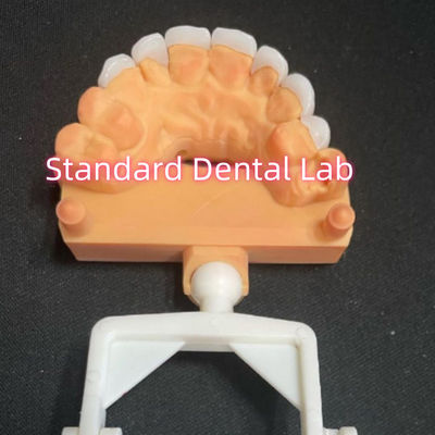 kupować Naturalnie wyglądający laminowany cyrkonia Emax veneers Grubość 0,6 mm produkcja internetowa