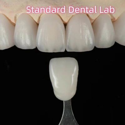 kupować Wysokiej estetyki naturalny, dostosowany do potrzeb, most dentystyczny z cyrkonii produkcja internetowa