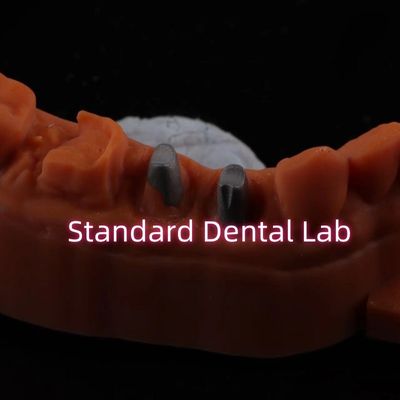 kupować Metalowe korony pośrodkowe CAD CAM Porcelana / Zirkonia Cope Full Zircnonia Bruxier Korony produkcja internetowa