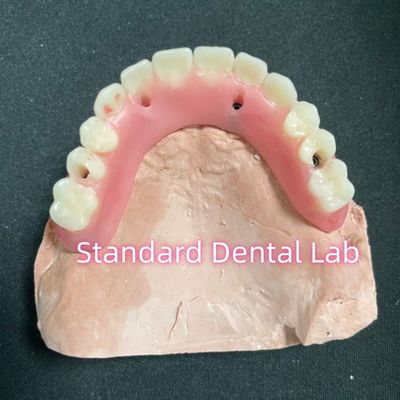 kupować Akrylowy częściowy implant nad protezą Tyzaniowy pręt z pełną protezą Zęby ustawione produkcja internetowa