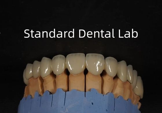 kupować Chiny Dental Laboratory Metal Ceramic Crown PFM Crown Wysoka estetyka produkcja internetowa