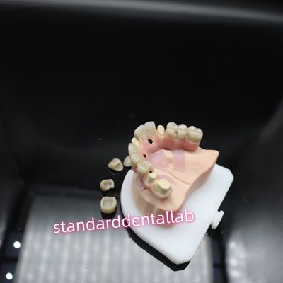 kupować Digital Dental Malo Implant Bridge Titanium Ivoclar Hybrid Zirconia Bridge produkcja internetowa