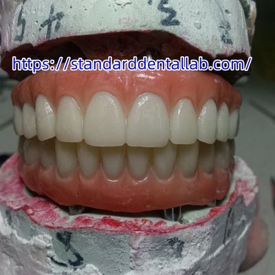 kupować Implant zębowy Korona tymczasowa Most PMMA z różowym porcelanem produkcja internetowa