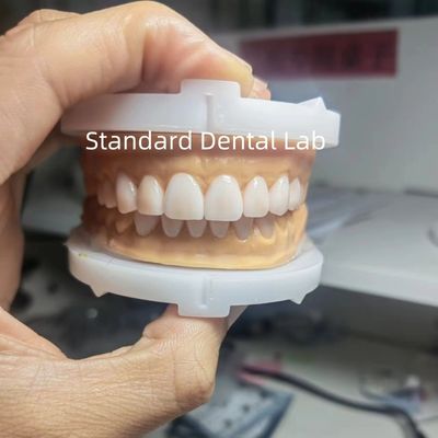 kupować Doskonała estetyka tymczasowa woskowanie dla dentystów używających wosku z China Dental Lab produkcja internetowa