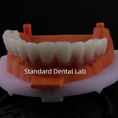 kupować Dobrze pasujące Precyzyjne Estetyczne Zirkonia Porcelana Korona Różowa Porcelana Z Cieniem Błyszczącym produkcja internetowa