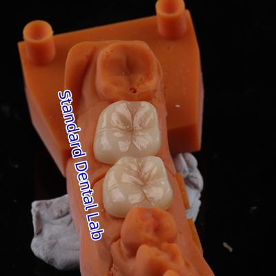 kupować Całkowity Kontur Zirkonia korony przezroczystość 3D PRO bez porcelanowej nakładki Standardowe laboratorium stomatologiczne produkcja internetowa
