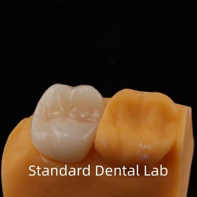 kupować 5-letnia gwarancja pełnego konturu Zirkonia Korona dla zębów grzbietowych Noritake Porcelana Wykonana przez zaufane laboratorium stomatologiczne produkcja internetowa