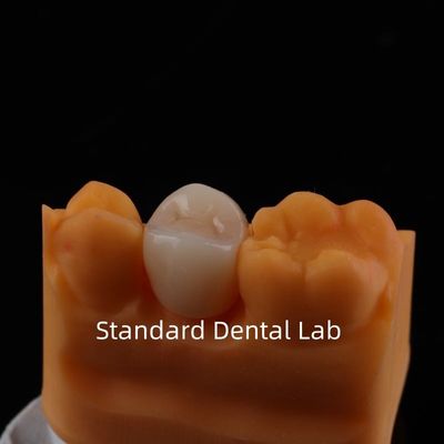kupować Pełny kontur Zirconia Korona Wyjątkowa wytrzymałość i estetyka Bez porcelanowej nakładki Korona tylna China Dental Lab produkcja internetowa