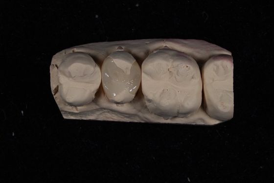 kupować Wytrzymałość Emax Ceramic Veneers Crown z doskonałą odpornością na plamy / biokompatybilnością produkcja internetowa