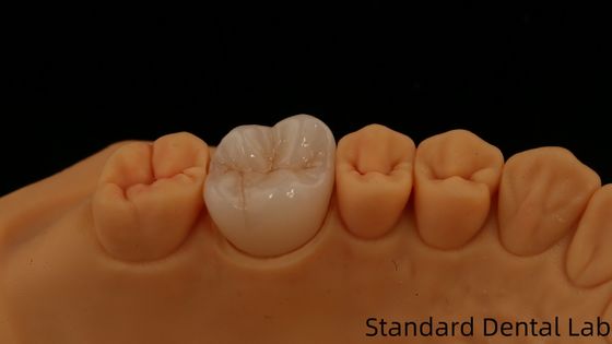 kupować Noritake Porcelana pełny kontur Zirconia Crown Customized Vita Shade dla estetycznej cyfrowej restauracji zębów przez laboratorium stomatologiczne produkcja internetowa