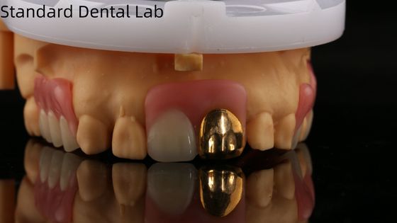 kupować Zęby pełne z żółtego złota/Zęby tymczasowe zęby akrylowe Ivoclar Professional zatwierdzone przez FDA produkcja internetowa