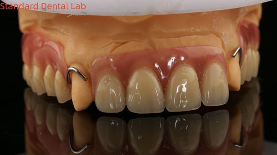 kupować Zęby cząstkowo akrylowe, wyleczone cieplnie, laboratorium stomatologiczne, wysoka dokładność z modelem druku 3D produkcja internetowa