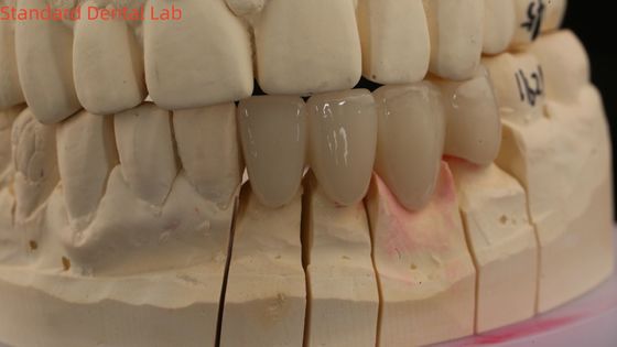kupować Korony stomatologiczne 3D Pro wysokiej przezroczystości pełne korony z cyrkonii z odcieniem Vita produkcja internetowa