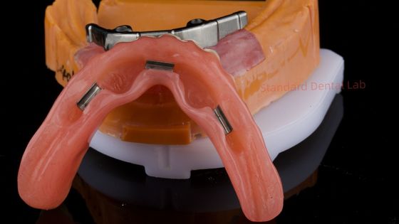 kupować Ivoclar Digital Dental Implant Bar Denture with Attachments Full Acrylic Denture Titanium Implant Supported Dentures produkcja internetowa