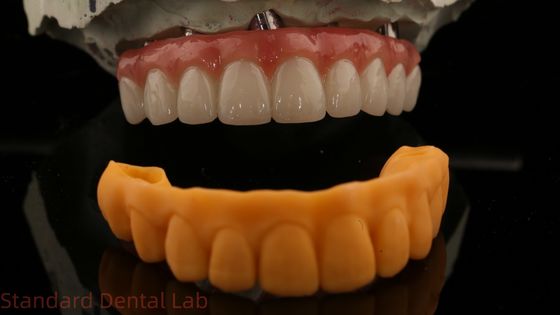 kupować 5 lat gwarancji Korona implantów dentystycznych PMMA Most Over Multi Unit Abutments produkcja internetowa