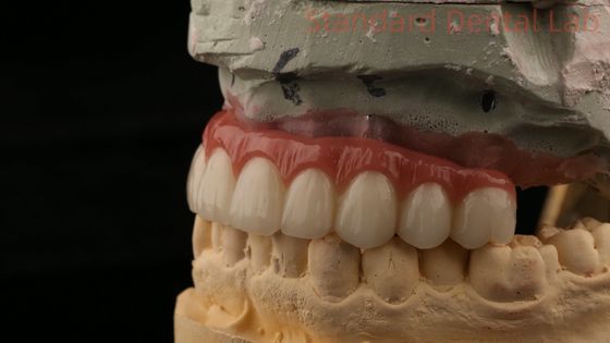 kupować Hybrydowy titanowy śrubokręt z implantem zębów Korona All On 4 Zębów Implant Zirconia most produkcja internetowa