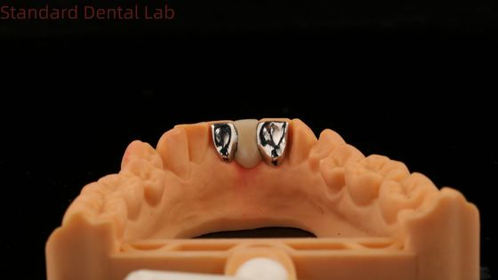 kupować Stomatologiczny PFM Maryland Bridge Wysoka estetyka FDA certyfikowany z Vita Porcelian China Dental Lab produkcja internetowa