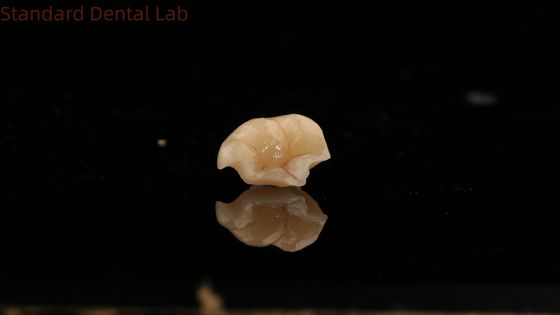 kupować Siła Emax Ceramic Crown Dental Onlay z doskonałą odpornością na plamy China Dental Lab produkcja internetowa