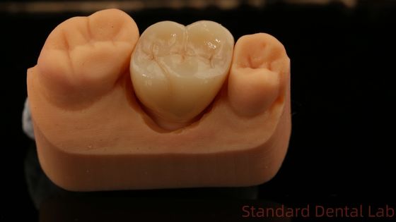 kupować Młyn i centrykacja, pełna korona z cyrkonii, chińskie laboratorium stomatologiczne szybka dostawa produkcja internetowa