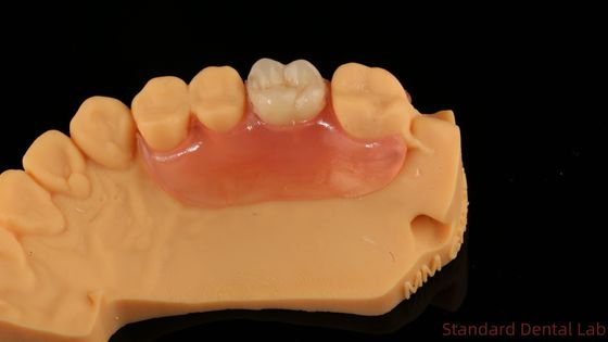 kupować Zębowe TCS Valplast Elastyczne zęby częściowe Nesbit Valplast Finish China Dental Lab Valplast Clap produkcja internetowa