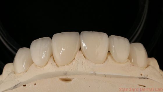 kupować Precyzyjny Zirconia Crown Bridge Komfortowe dopasowanie / estetyka 3-4 dni Szybki czas realizacji produkcja internetowa