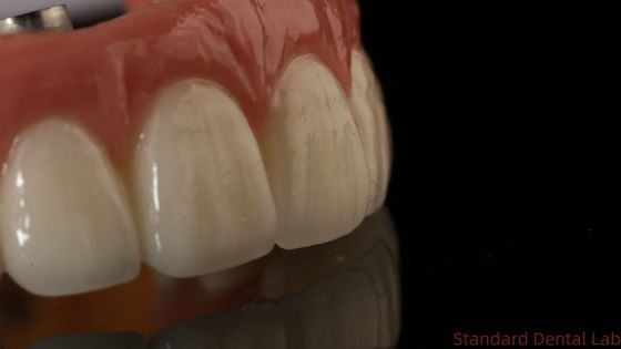 kupować Profesjonalne Zirkonia Implanty Stomatologiczne Korona Tytanium CAD CAM Zirkonia Korona China Dental Laboratory produkcja internetowa