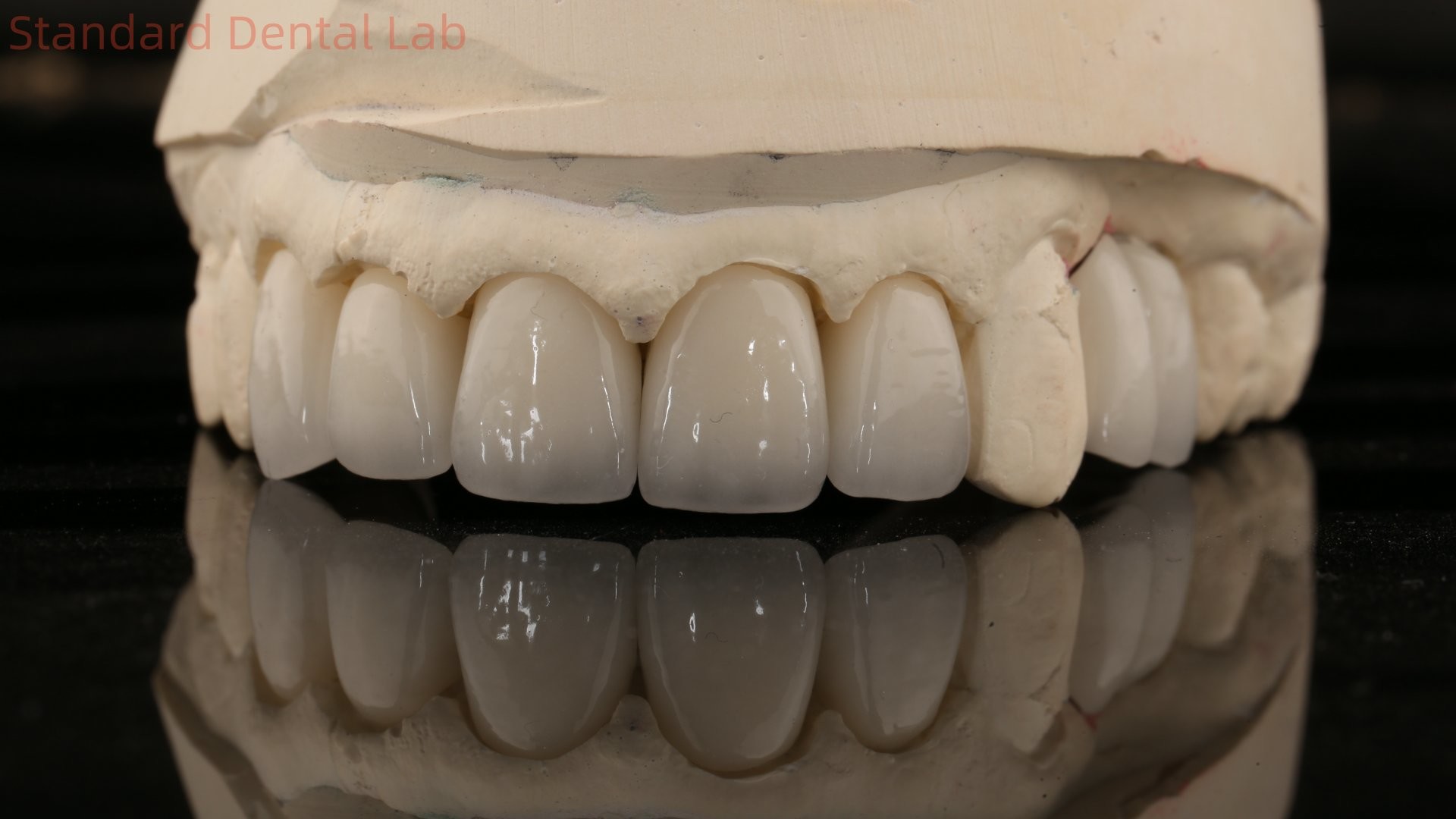 Full Contour Zirconia Crown