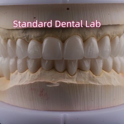 Laboratorium stomatologiczne pełnołukowe cyrkonia korony porcelanowe PFZ korony ISO FDA CE