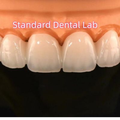 Zirkonia Korony most Lab Dental z warstwami porcelany