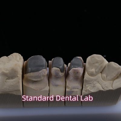 Metalowe odlewane korony rdzenia korony Cocr Precision Retentive Full Zirconia Bruxier