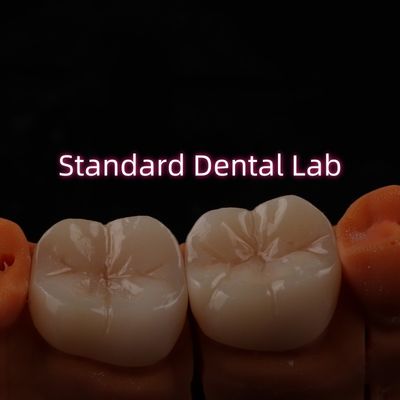 Całkowity Kontur Bruxier Monolit Zirconia Crown Bridge Lab Dental