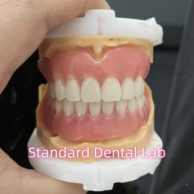 OEM Standardowe laboratorium stomatologiczne Zęby wyjmowalne łatwe do wprowadzenia i wyprowadzenia