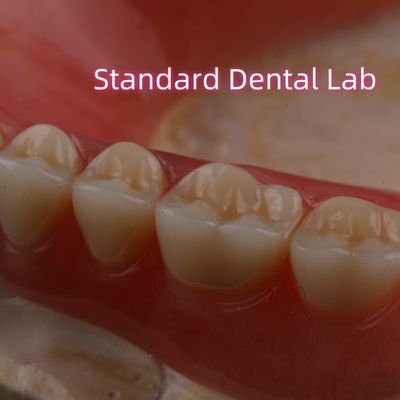 SDL Gorąco wytrzymały akrylowy częściowy protez zębów Ivoclar Zęby stomatologiczne Laboratorium Wysoka dokładność
