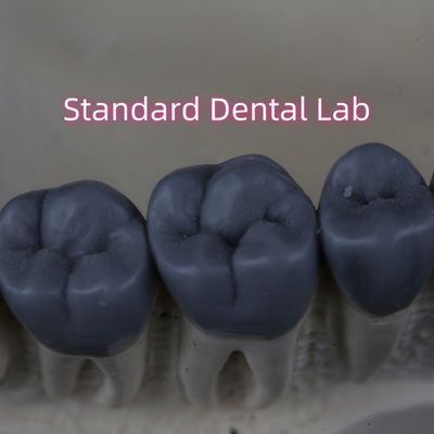 Profesjonalne cyfrowe laboratorium stomatologiczne Wax Up 3shape zatwierdzone przez FDA