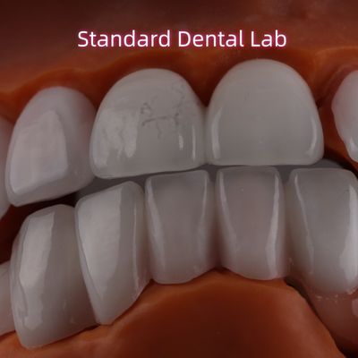Litium Dicilicate warstwa Ivoclar Emax Zirconia Laminate Veneers Przejrzysty OEM ODM