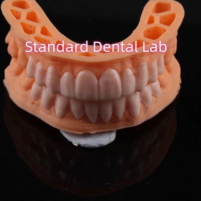 OEM ODM Pop On Veneers Niestandardowo wykonane Veneers Snap On Smile