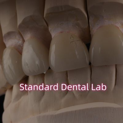 Profesjonalne laboratorium stomatologiczne Zirconia Crown For Fixed Restoration