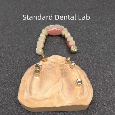 CAD CAM Ząb Częściowy Zęb Zęb Zębowy Specjalista Dokładny