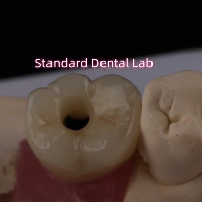 Poza Implant Crown Bruxier Solid Zirconia Screw Retained