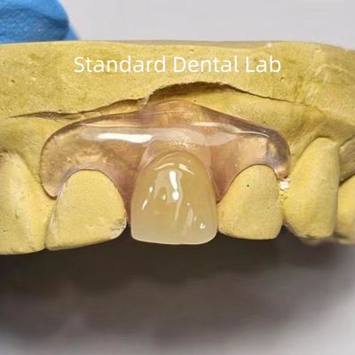 Stomatologiczne TCS Valplast elastyczne zęby częściowe Farbowanie zanikające zapachy odporne