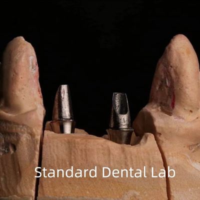 Zębowa porcelana Zirkonia Implant Korona Profesjonalna wysoka estetyka